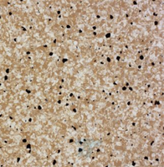 Линолеум токопроводящий Titan Vinyl  SHIELD XYR-608